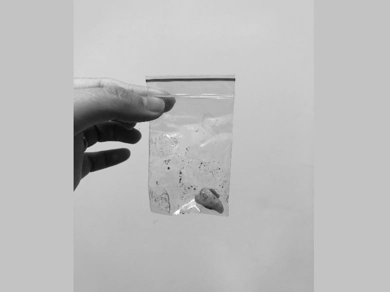 隨意閒聊-近期自己拔水平智齒經驗